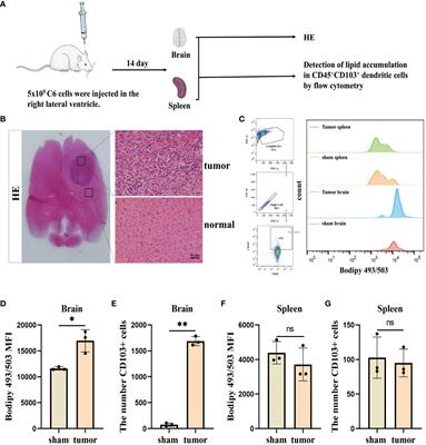 Glioblastoma-derived exosomes promote lipid accumulation and induce ferroptosis in dendritic cells via the NRF2/GPX4 pathway